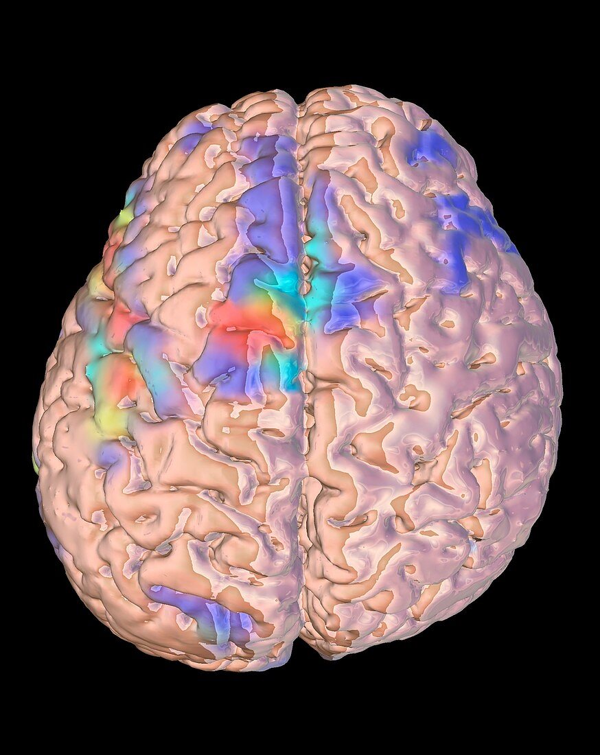 Brain activity during a visual language task, fMRI scan