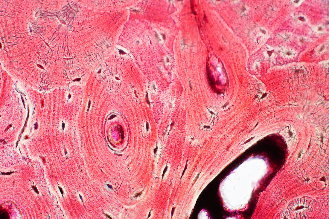 Human compact bone, light micrograph
