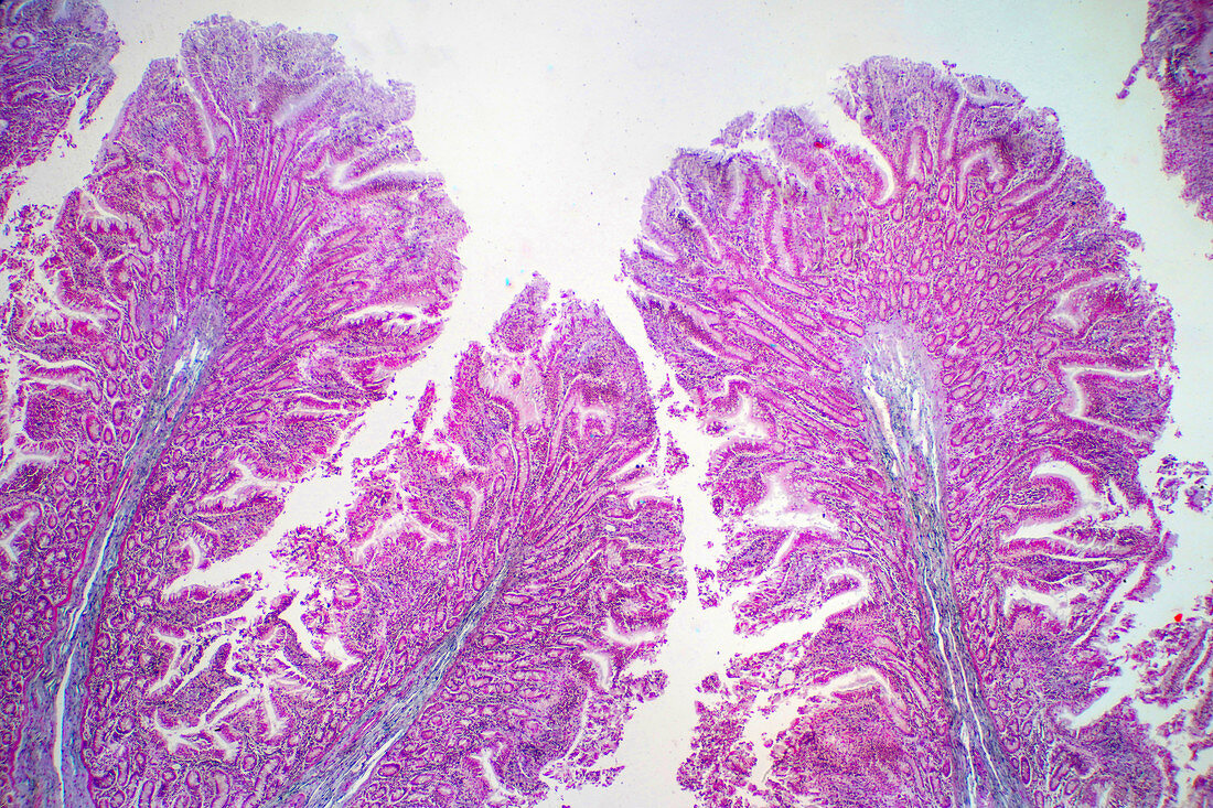 Human large intestine tissue, light micrograph