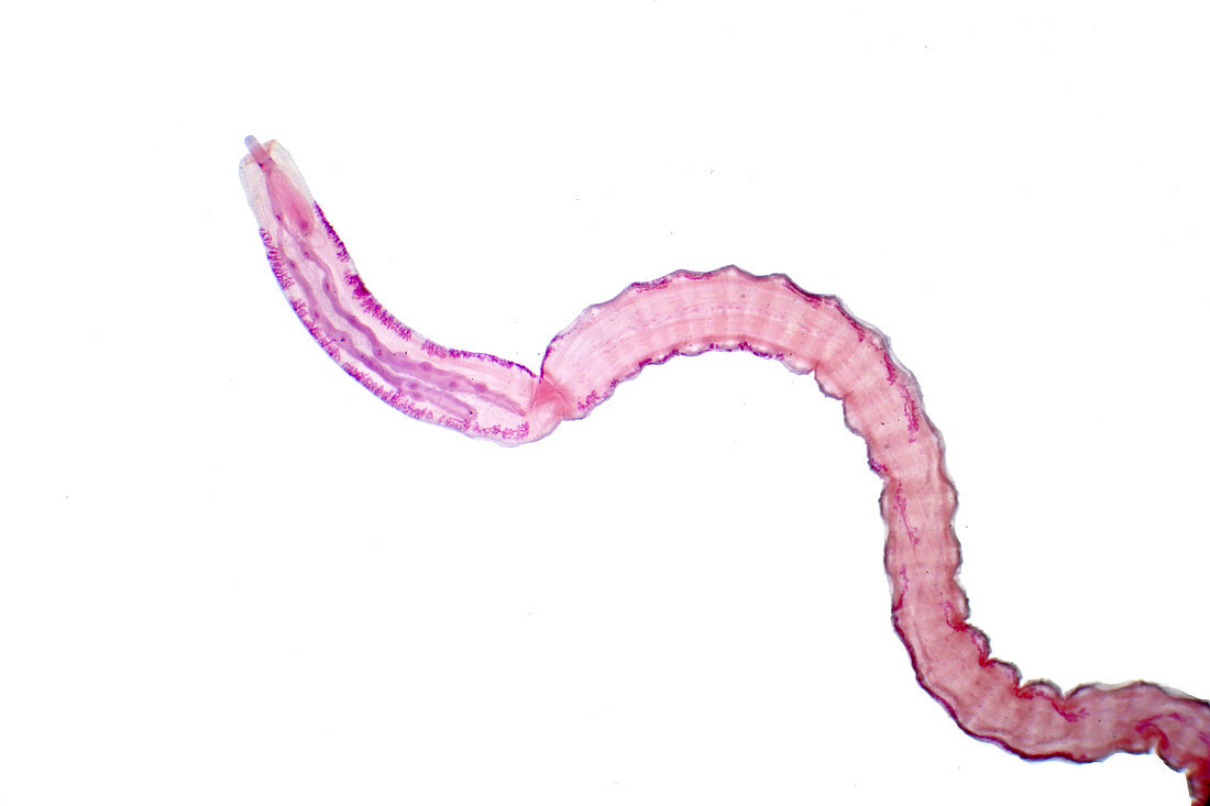 Tapeworm of cattle, light micrograph