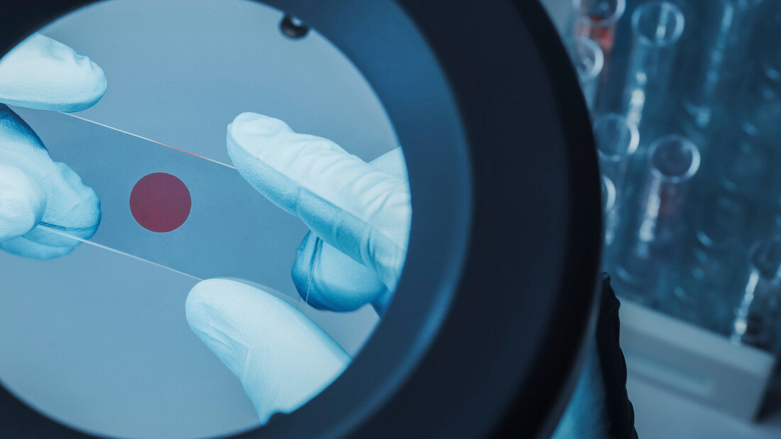 Hand in glove holding microscope sample plate