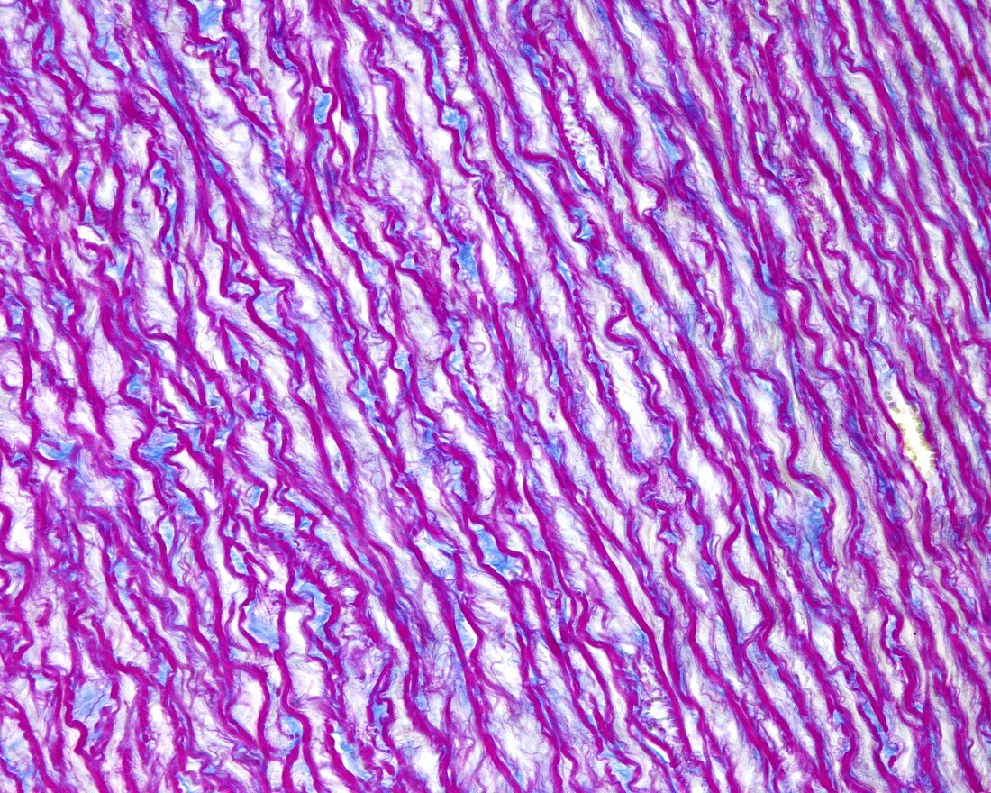 Aorta elastic lamellae, light micrograph