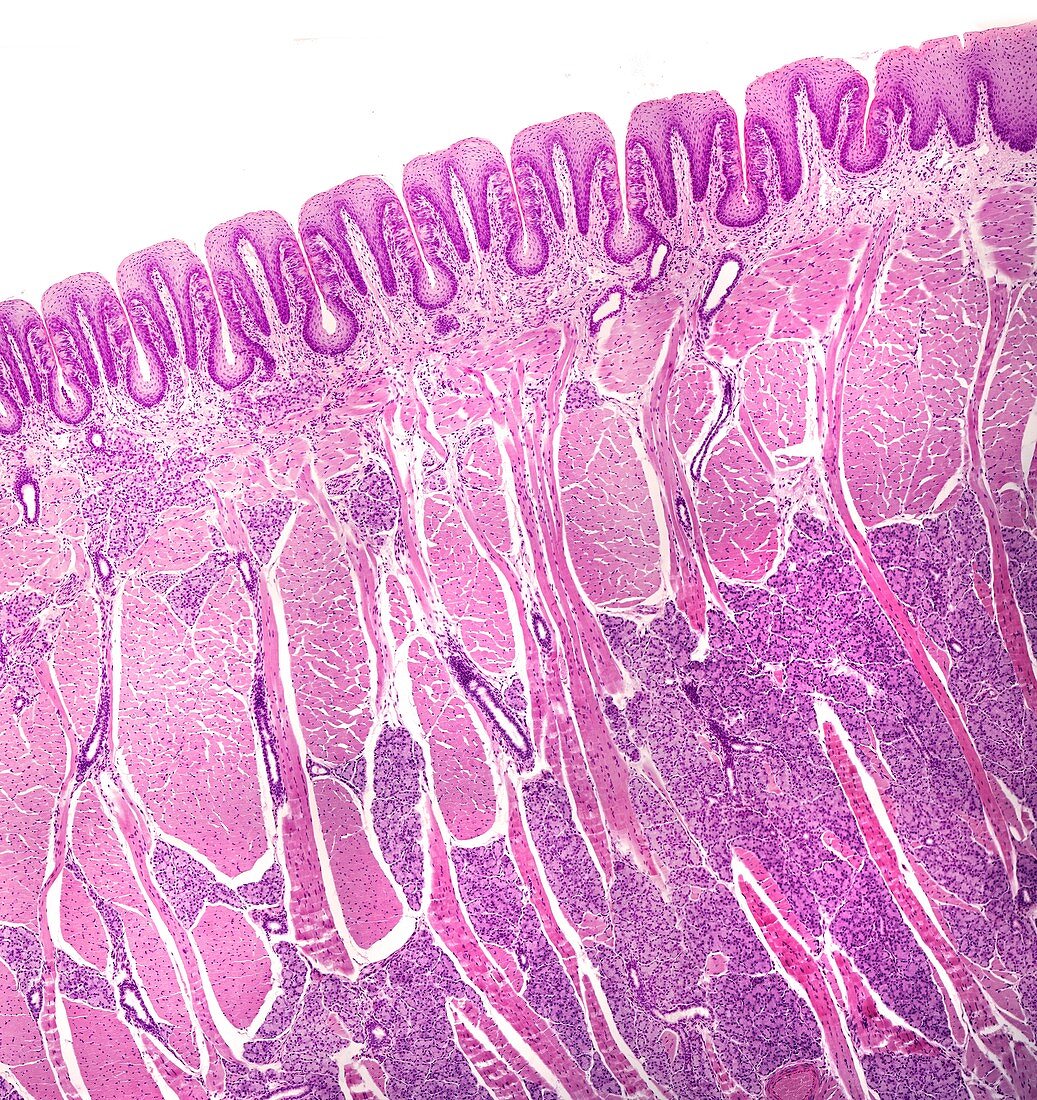 Foliate papillae with taste buds, light micrograph