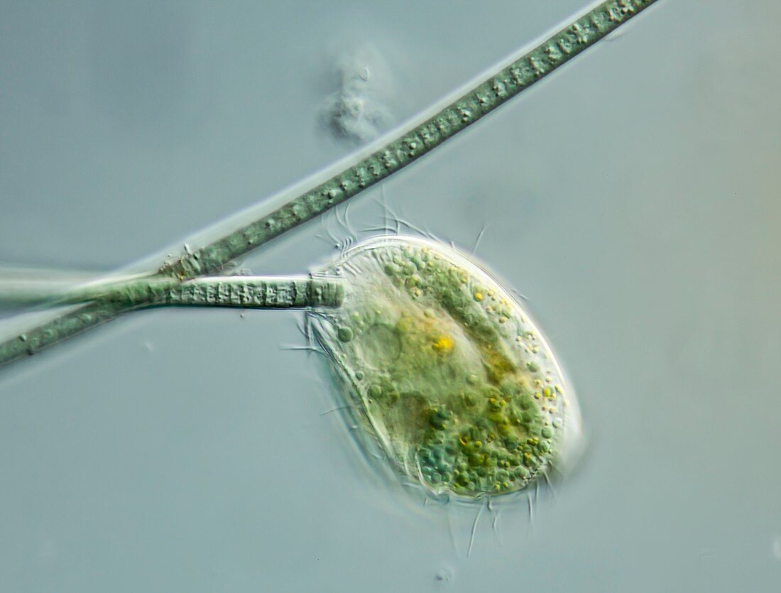 Pseudomicrothorax dubius ciliate, LM