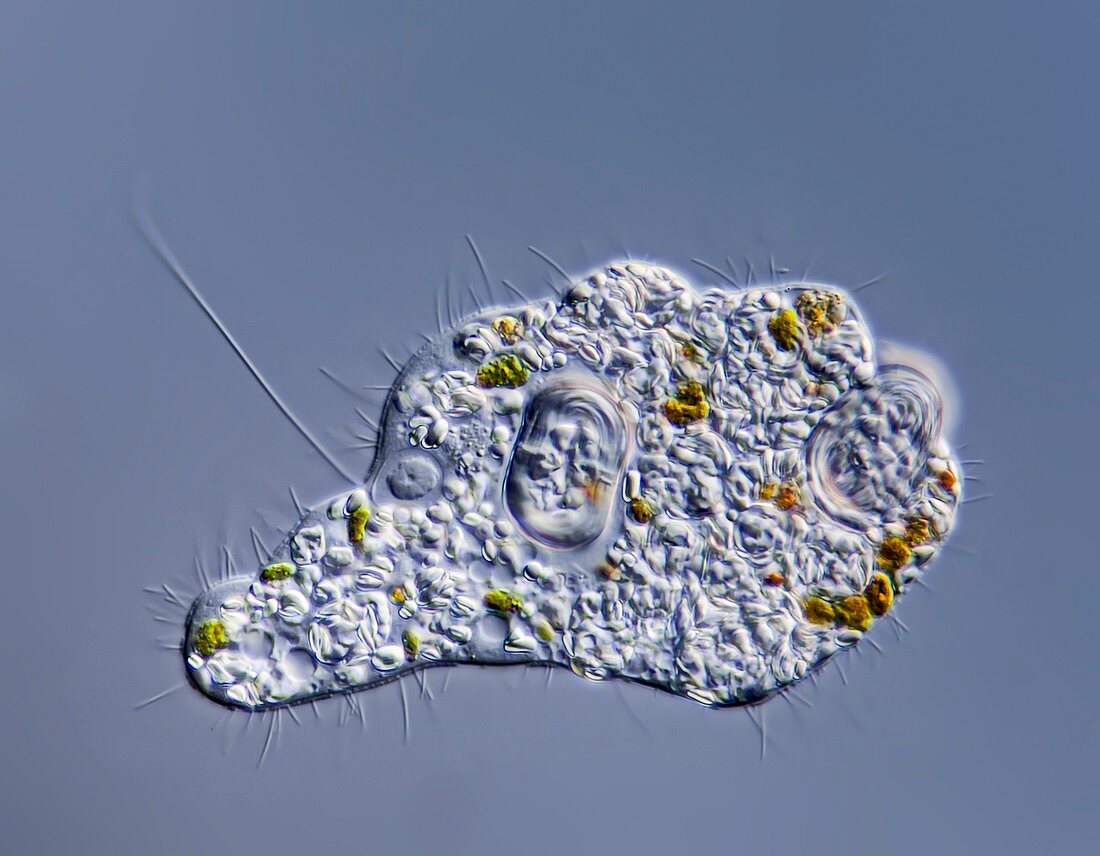 Freshwater amoeba, LM