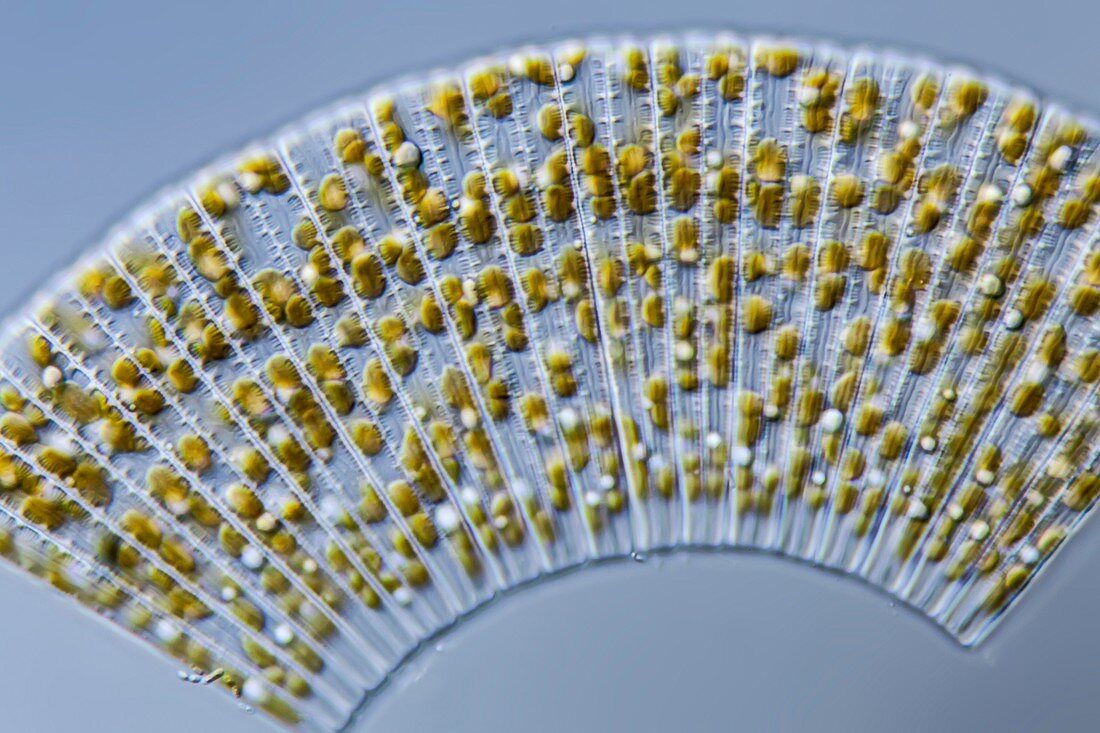 Meridion circulare diatoms, LM