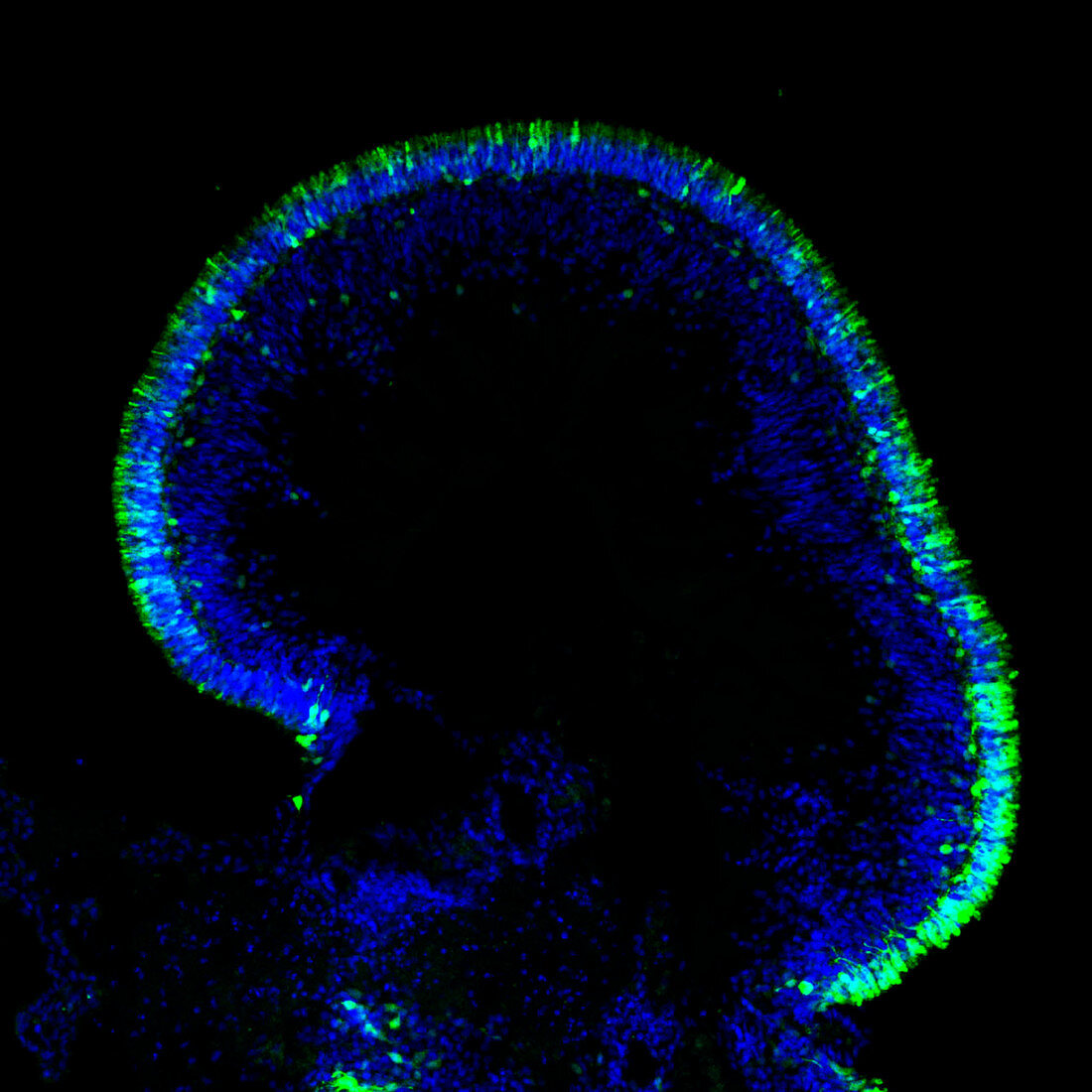 Human retinal organoid, fluorescent micrograph