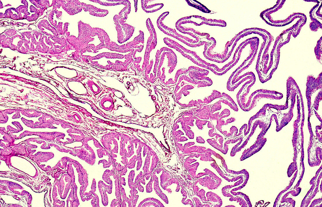 Fallopian tube ampulla, light micrograph