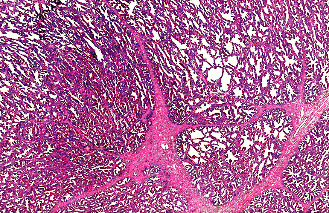Human prostate section, light micrograph