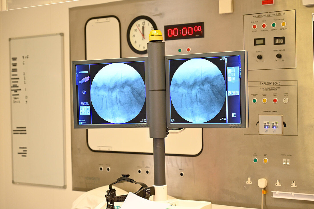 X-rays taken during surgery