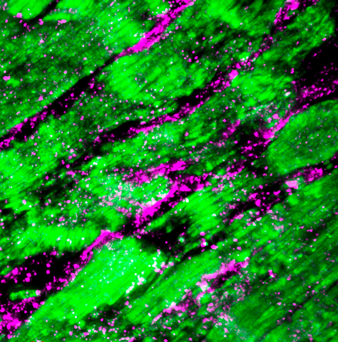Heart muscle, fluorescence micrograph