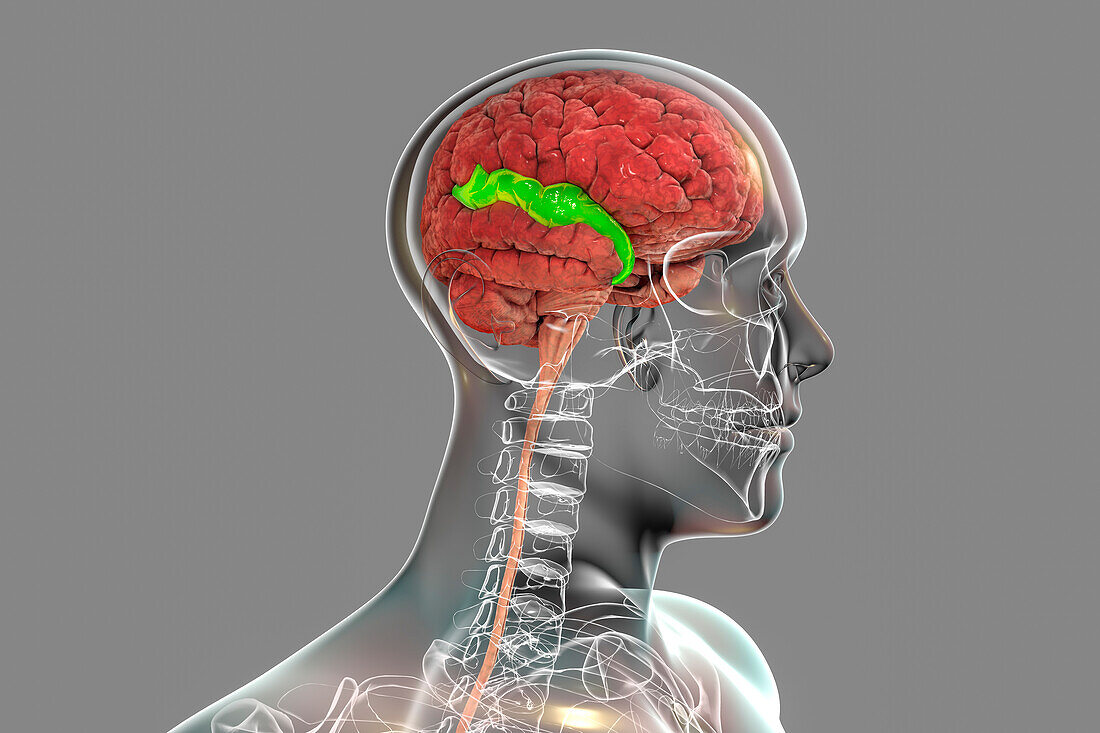 Brain with highlighted superior temporal gyrus, illustration
