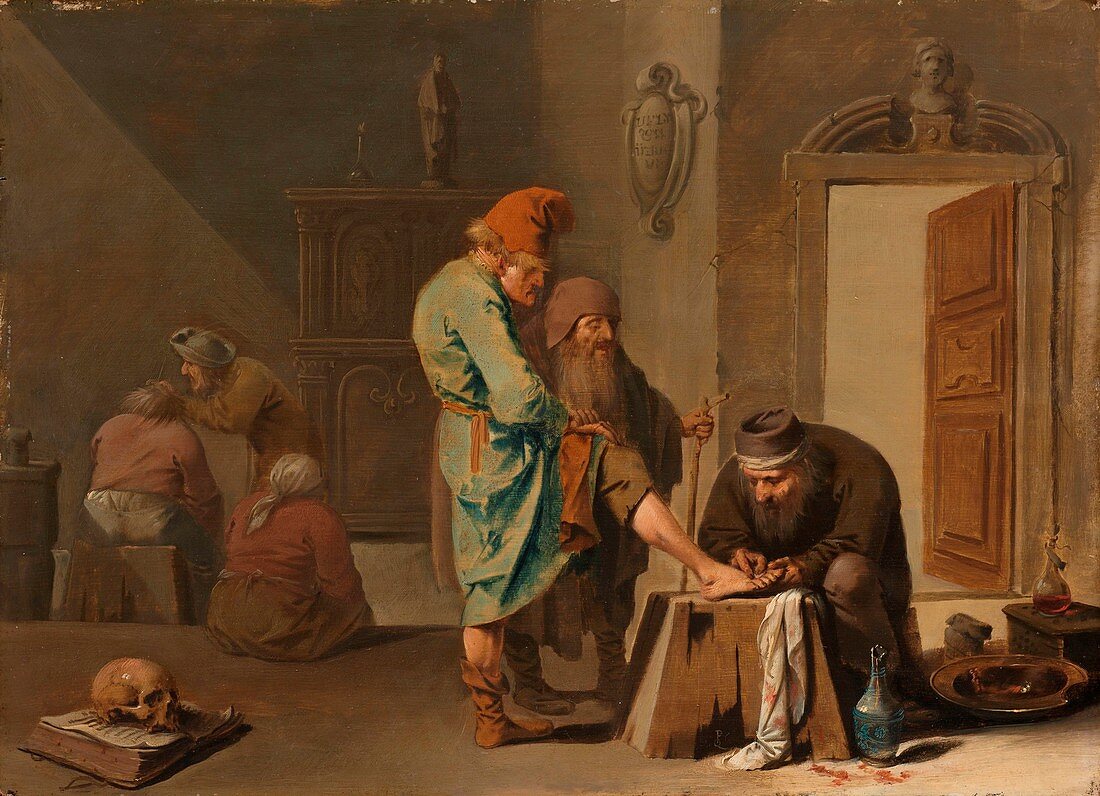 The foot operation, 17th century painting