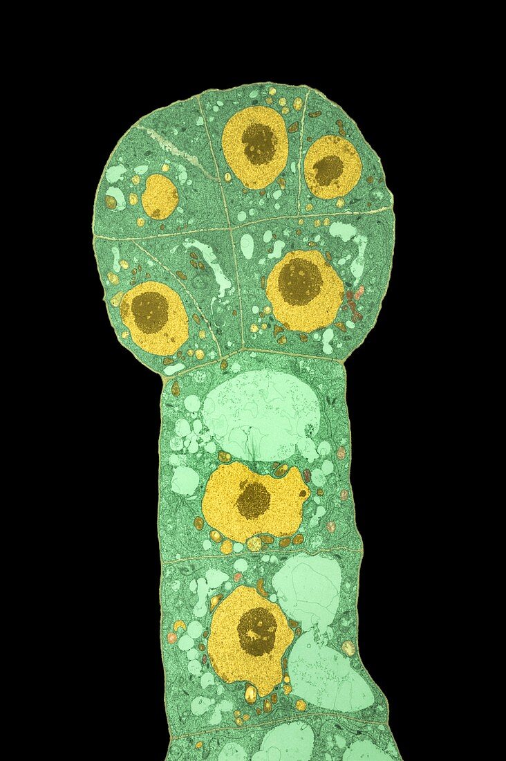 Developing turnip (Brassica campestris) embryo, TEM