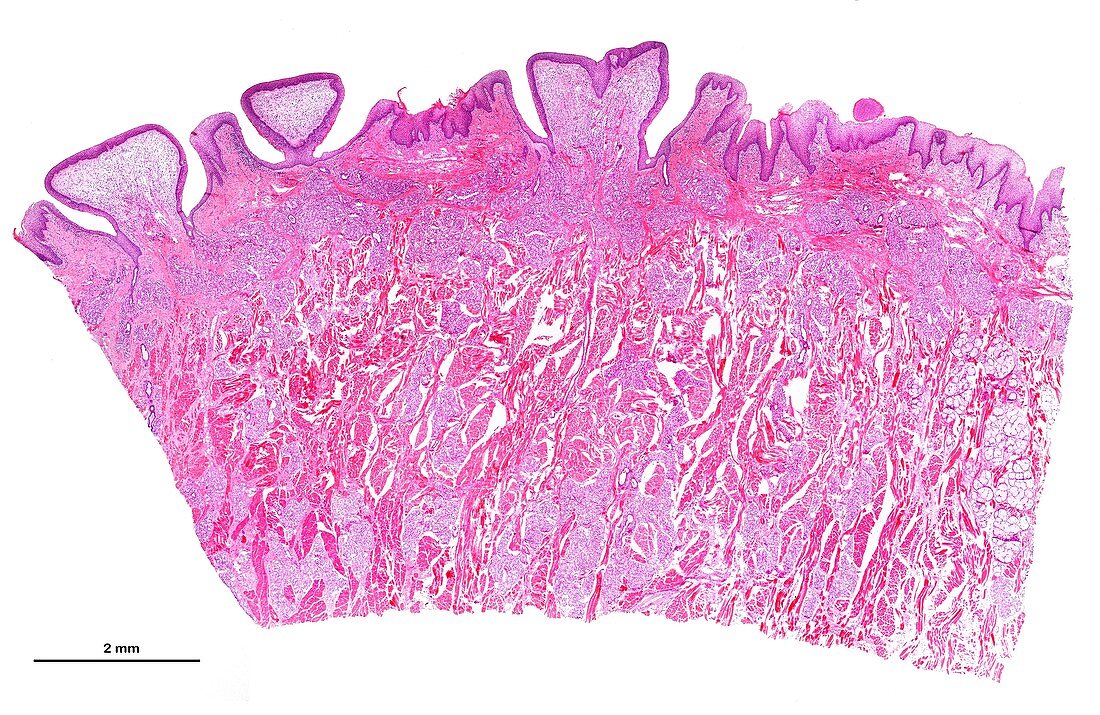 Vallate papillae of human tongue, light micrograph