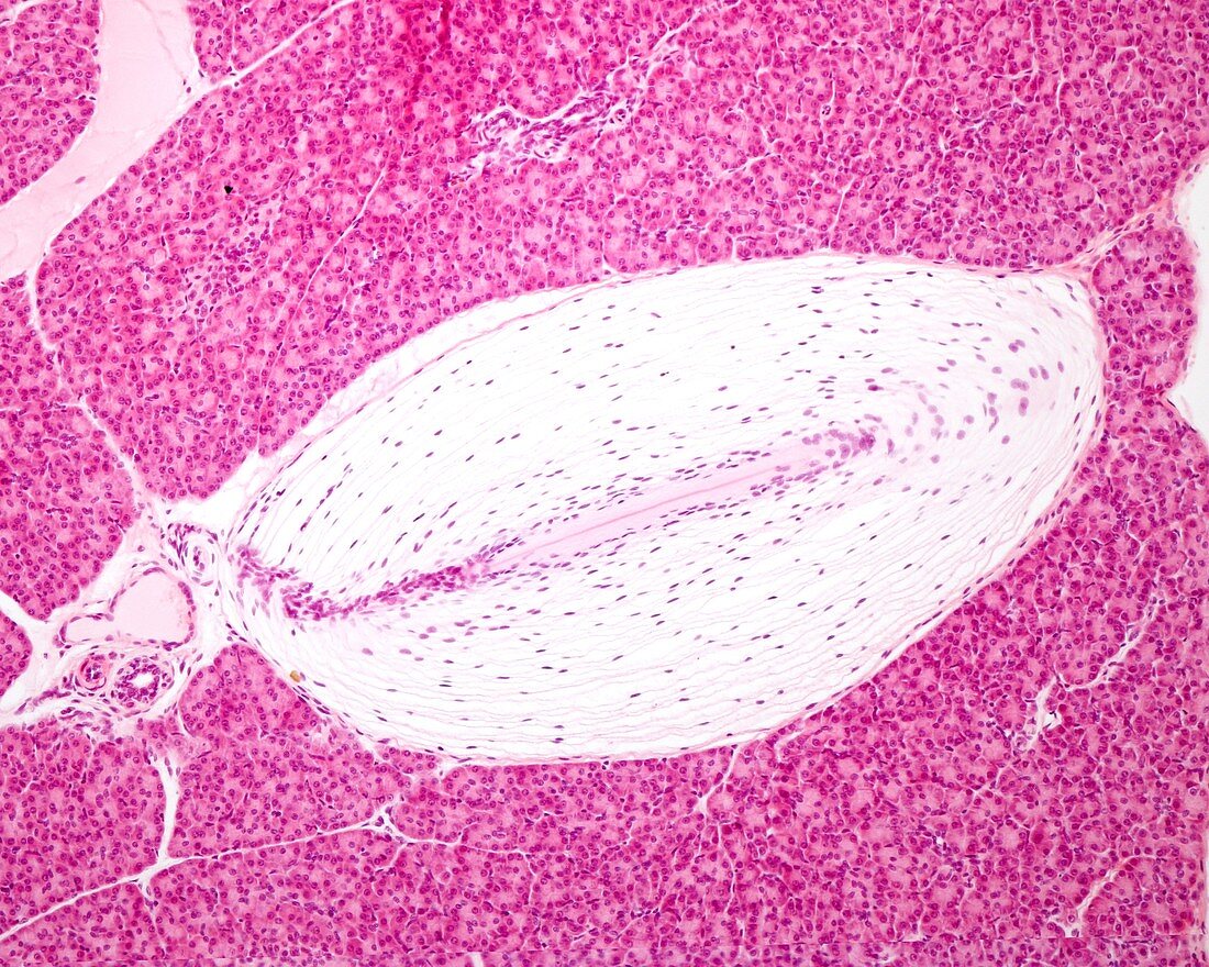 Pacinian corpuscle, light micrograph