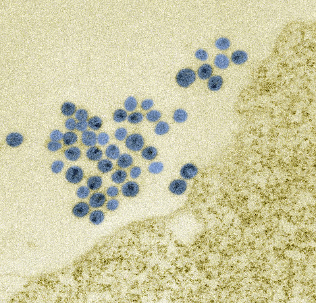 HIV particles on cell surface, TEM