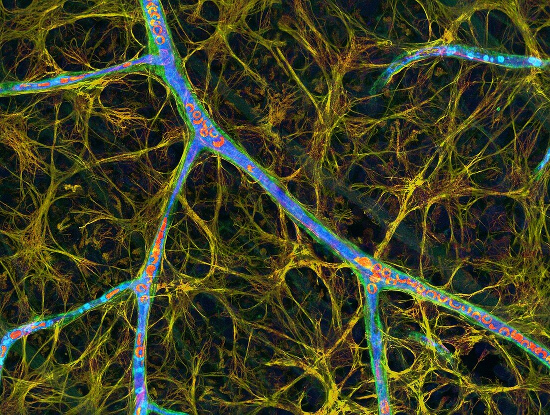 Brain blood vessels, confocal light micrograph