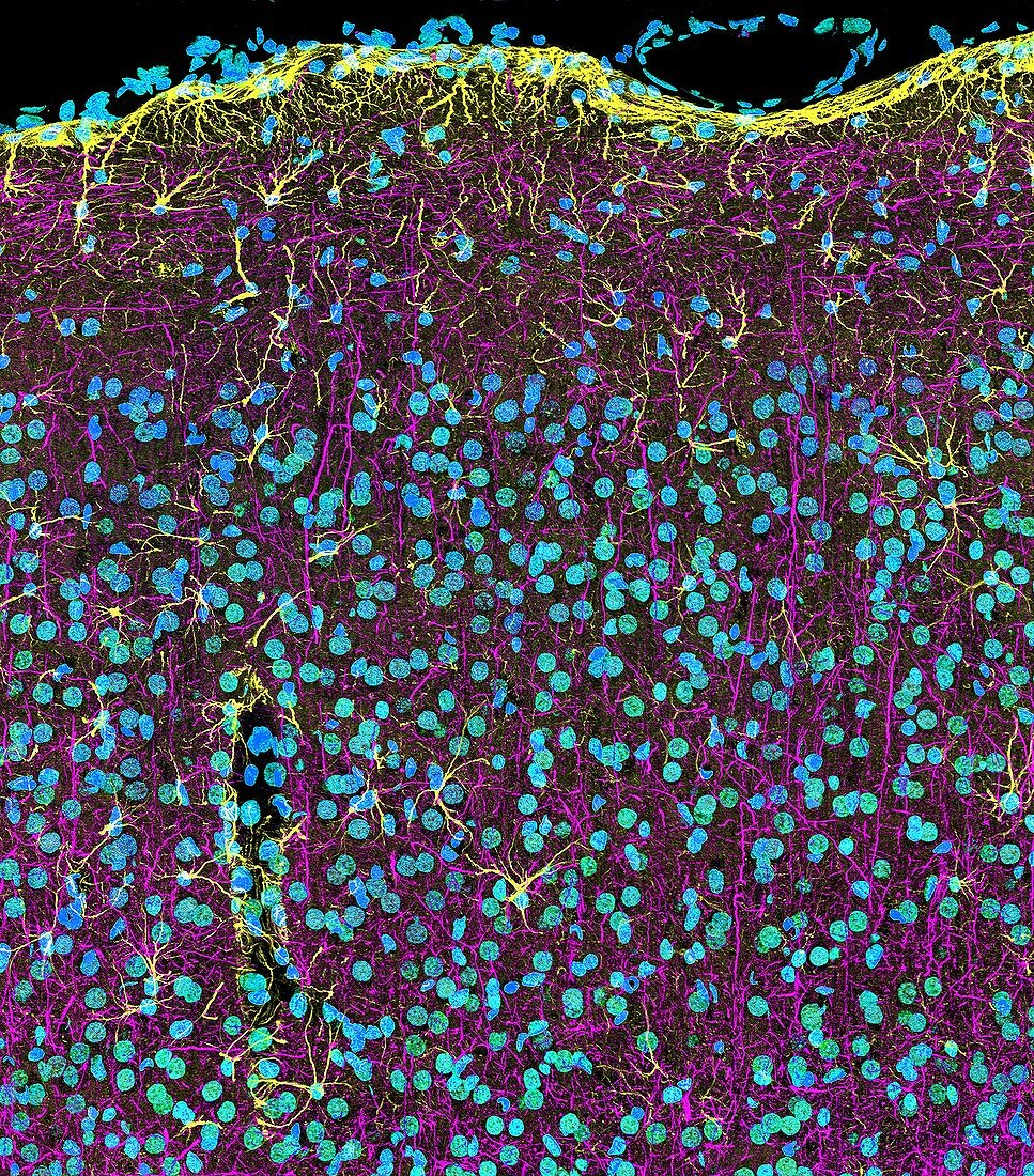 Brain cortex tissue, confocal light micrograph