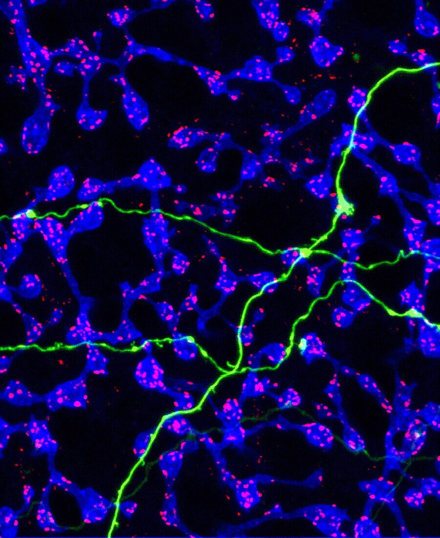 Amacrine cells in the retina, fluorescent micrograph