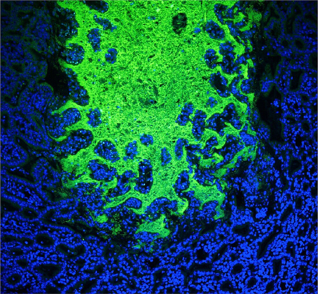 Gut bacteria, fluorescent light micrograph