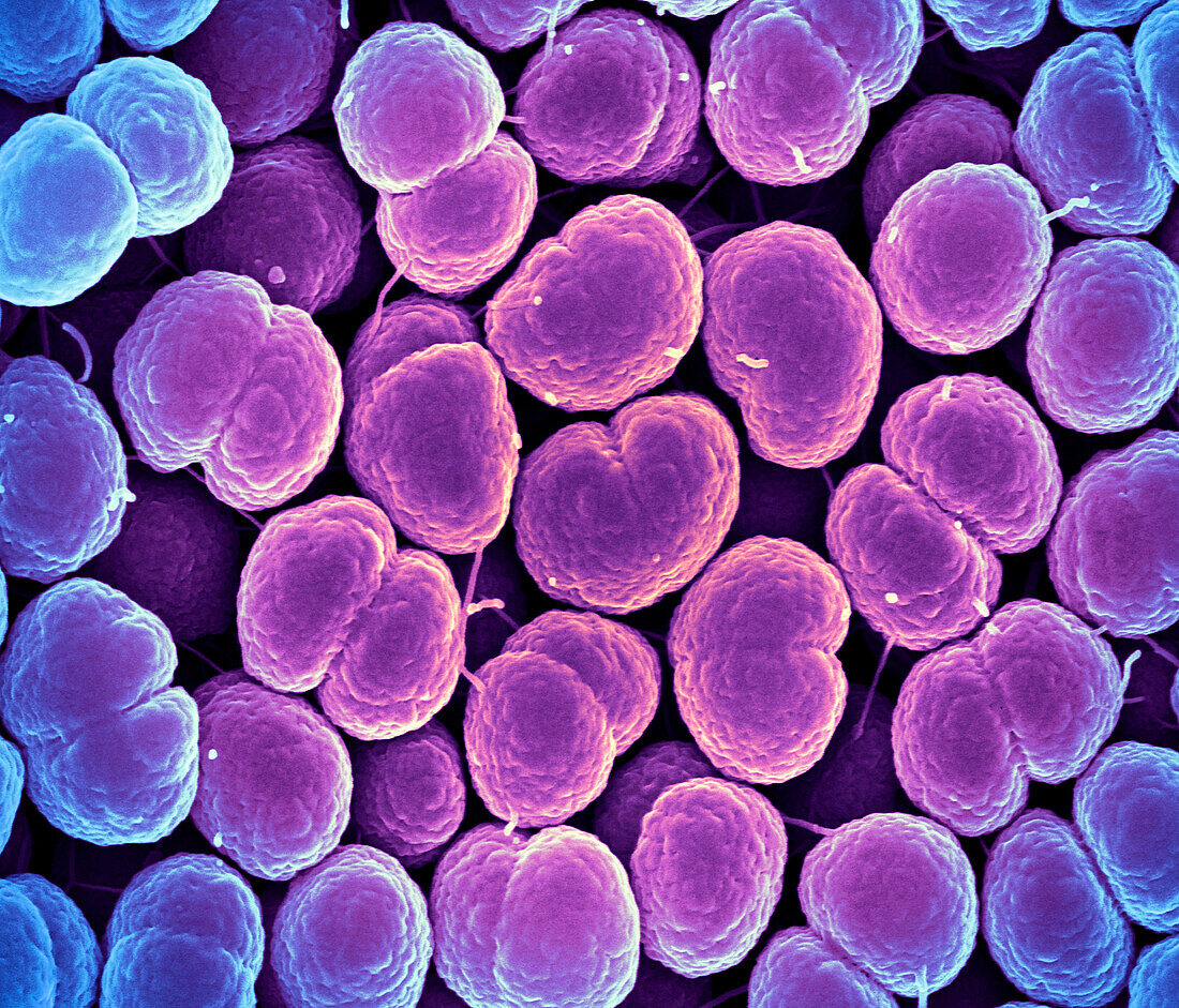 Gonorrhoea bacteria, SEM