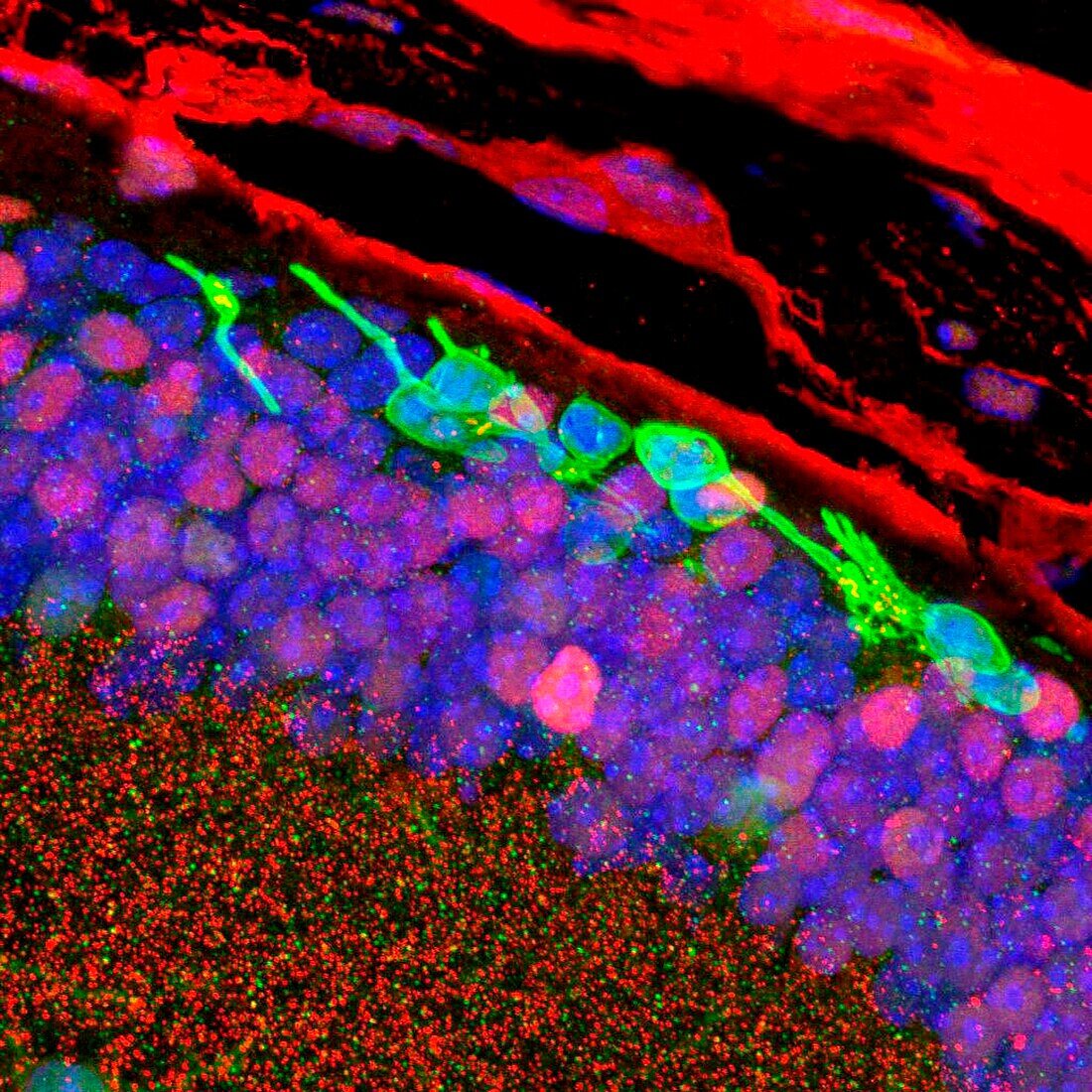Photoreceptor-like cells, fluorescent light micrograph