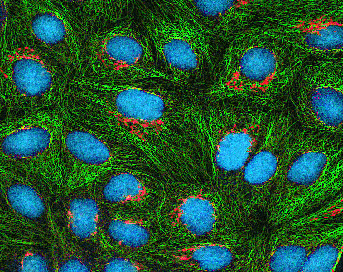 HeLa cells, fluorescence light micrograph