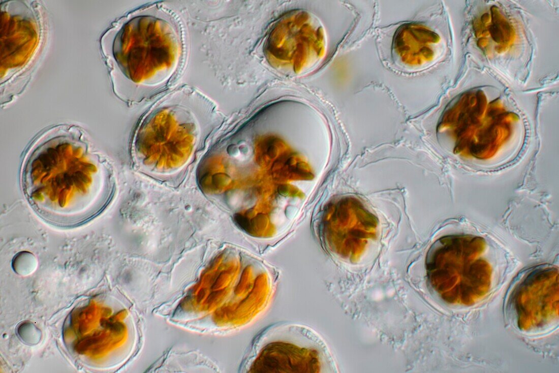 Campylodiscus sp. diatoms, light micrograph