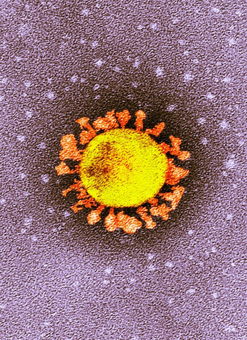 Covid-19 coronavirus, TEM