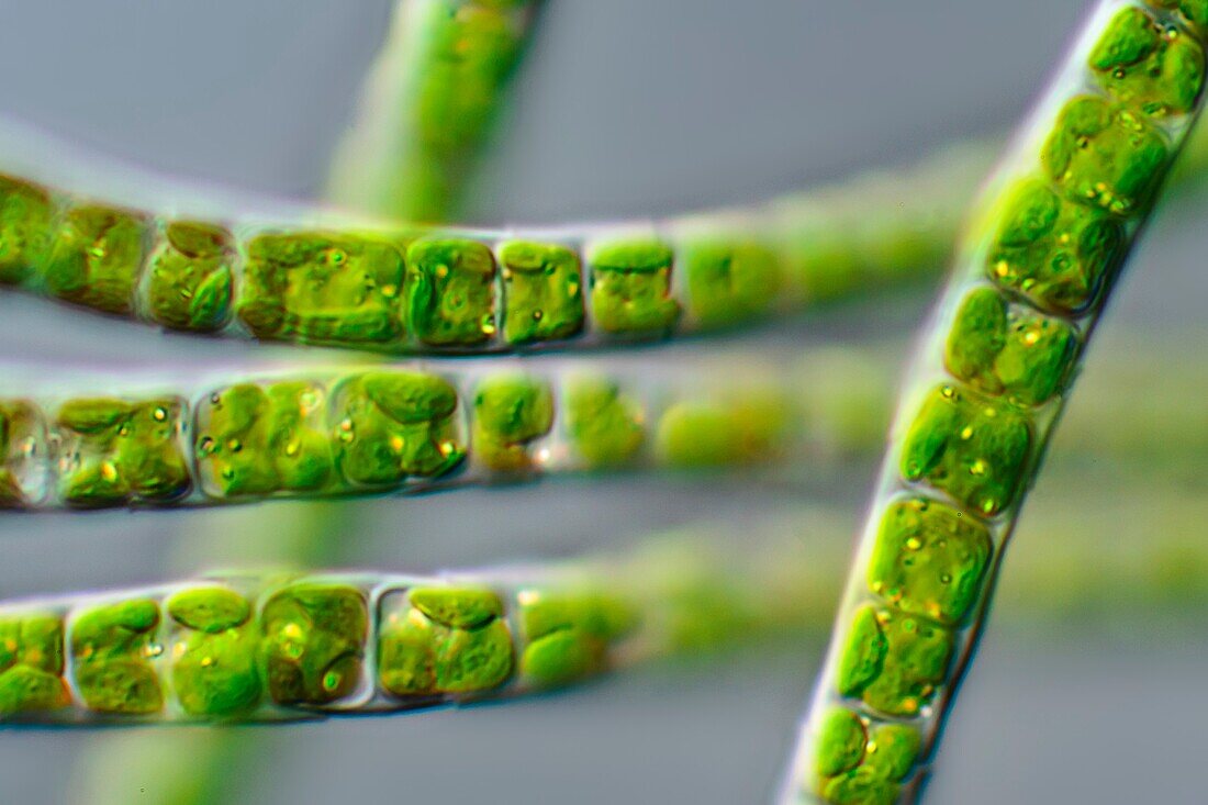 Microspora sp. algae, light micrograph
