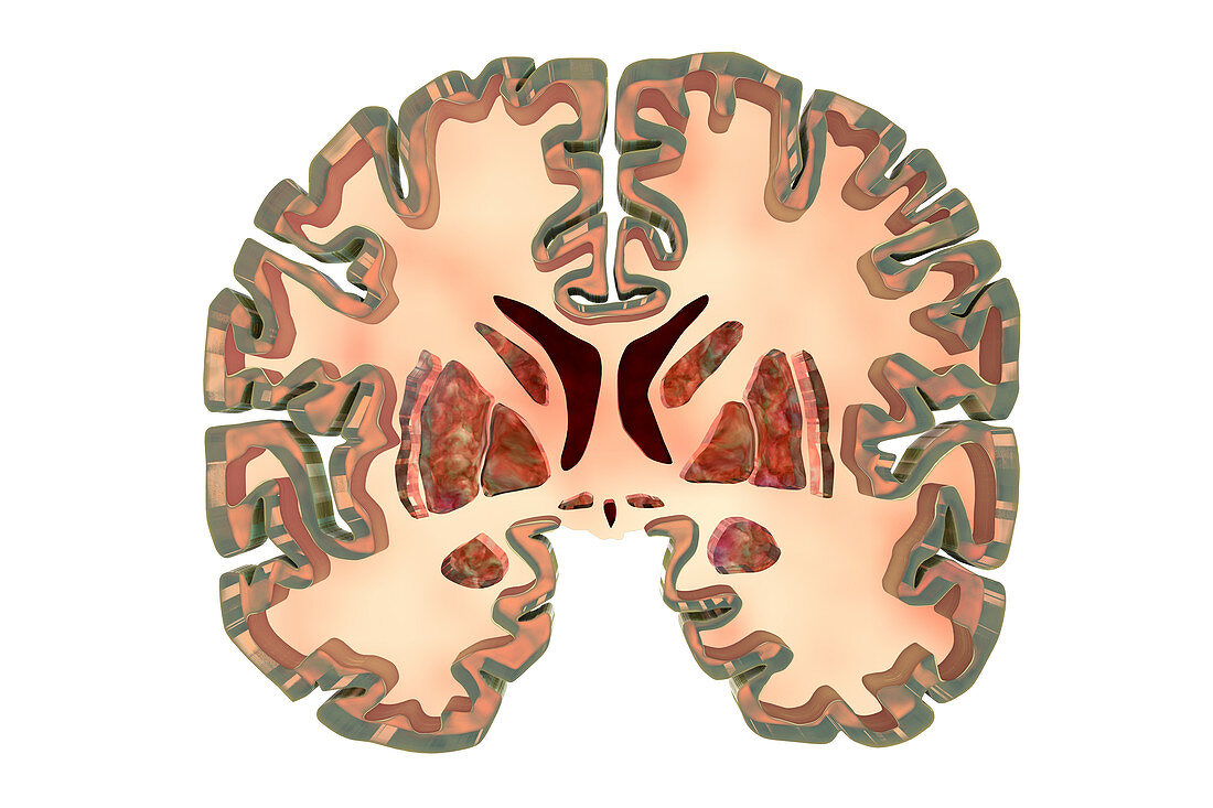 Coronal sections of a healthy brain, illustration