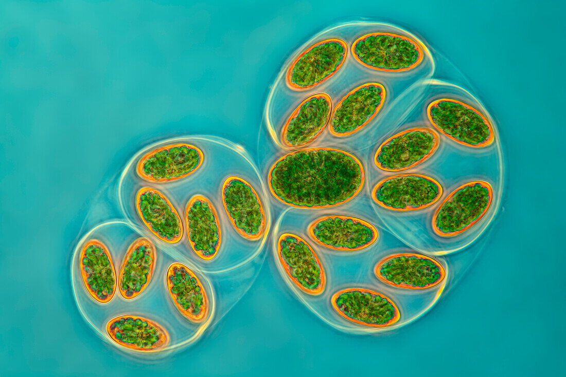 Glaucocystis algae, light micrograph