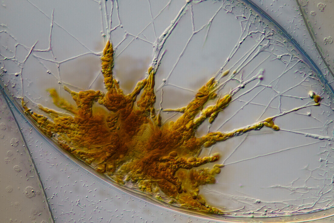 Pyrocystis sp., light micrograph