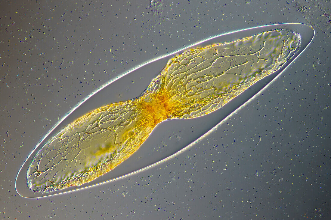 Pyrocystis sp., light micrograph