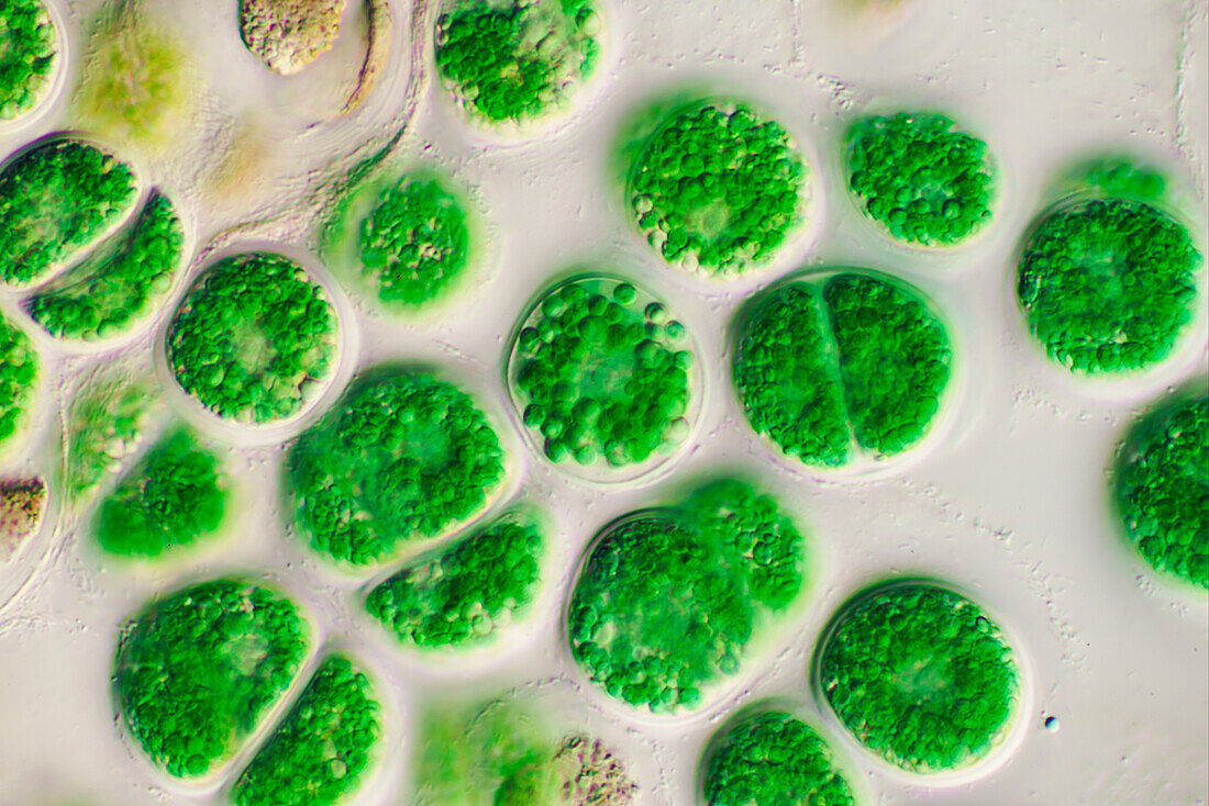 Cyanoptyche sp. green algae, light micrograph