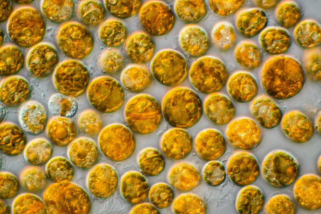 Symbiodinium dinoflagellates, light micrograph