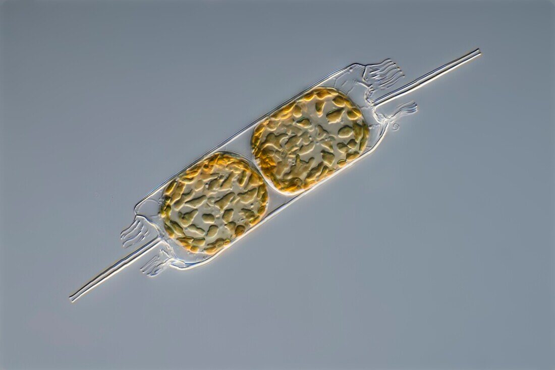 Ditylium diatom, light micrograph