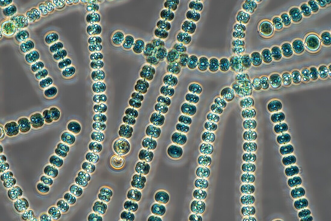 Anabaena cyanobacteria, light micrograph