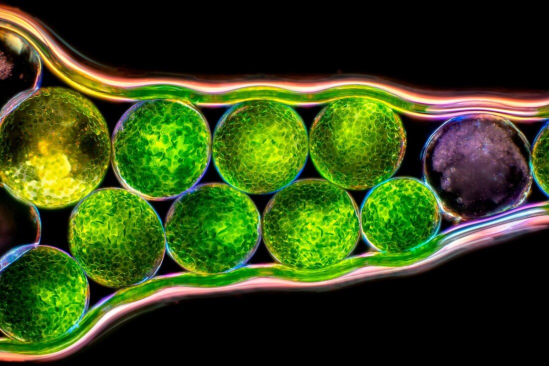 Eremosphaera viridis green algae, light micrograph