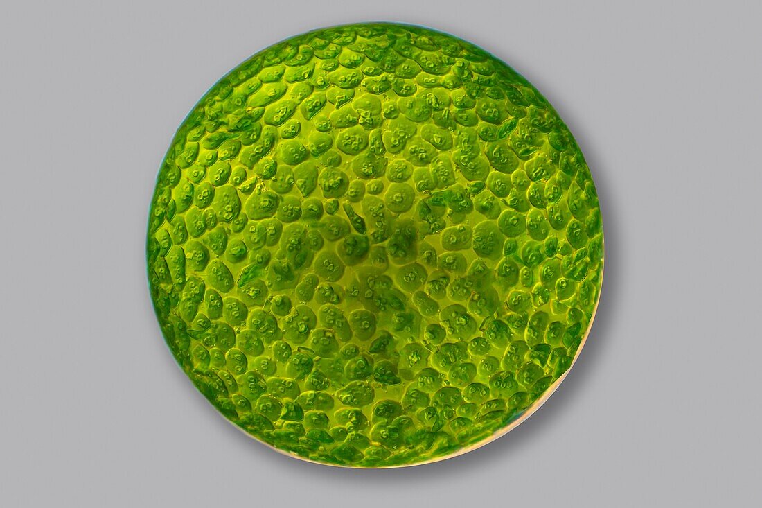 Eremosphaera viridis green algae, light micrograph