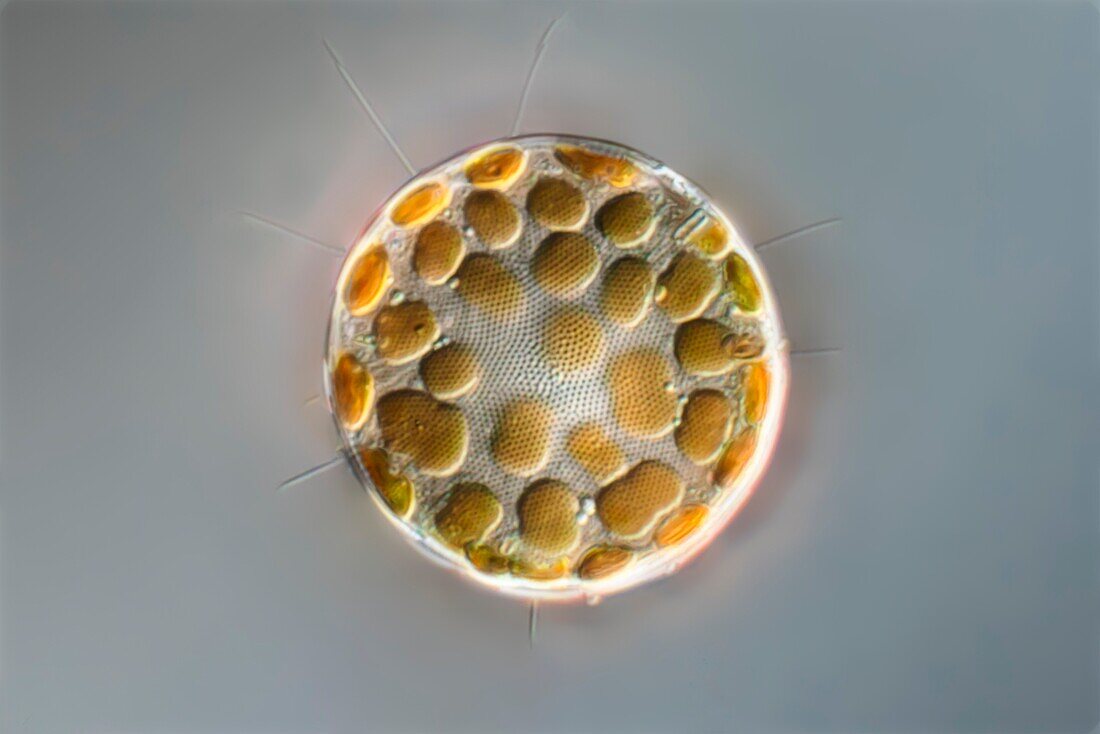Thalassiosira sp. diatom, light micrograph