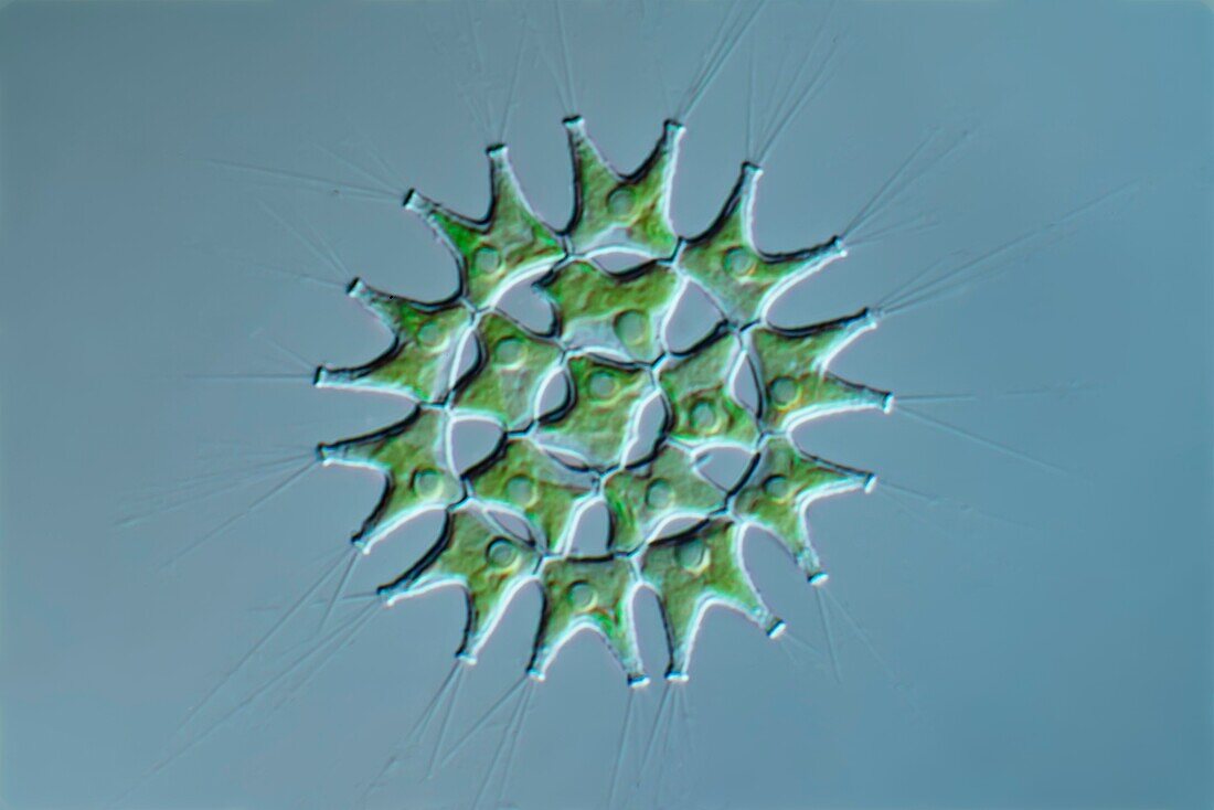 Pediastrum duplex cf. algae, light micrograph