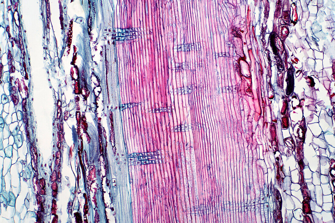Plant vascular tissue, light micrograph