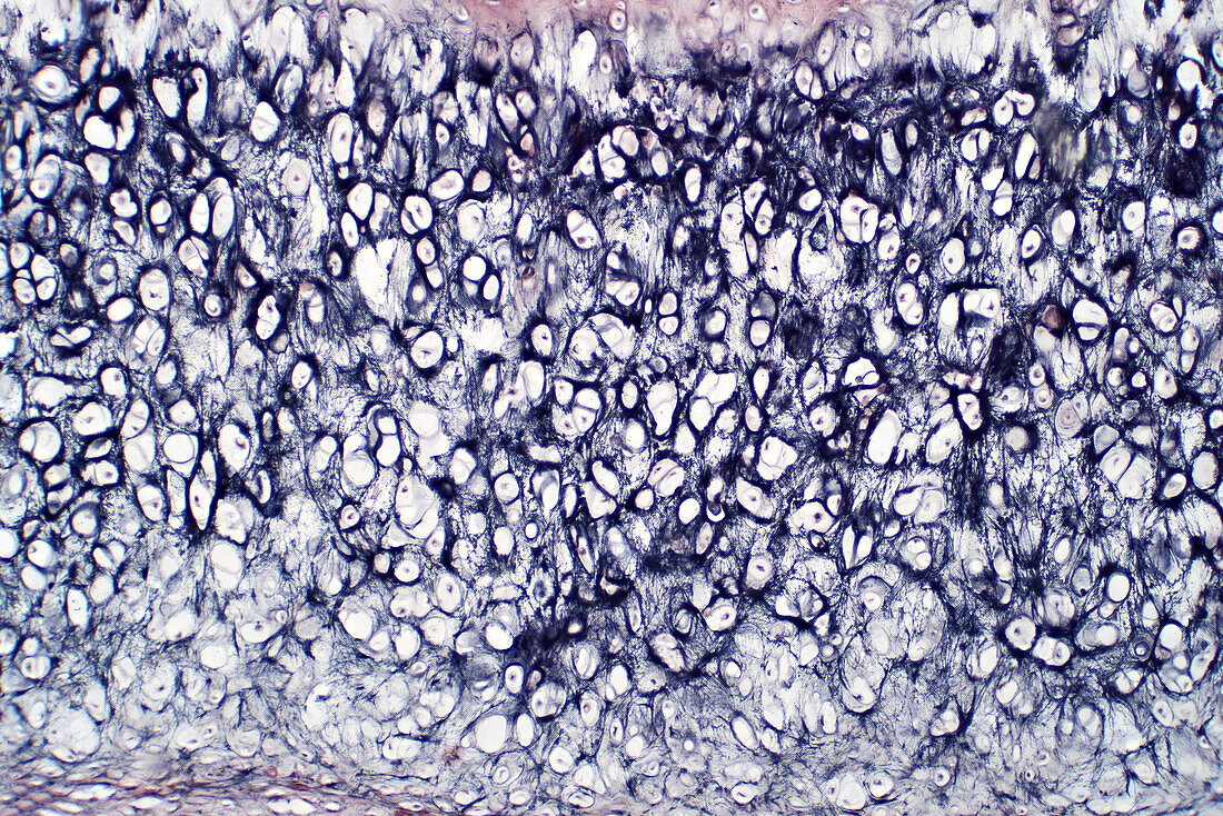 Cross section of human cartilage and bone, light micrograph