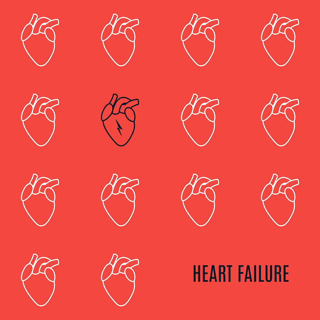 Heart failure, conceptual illustration