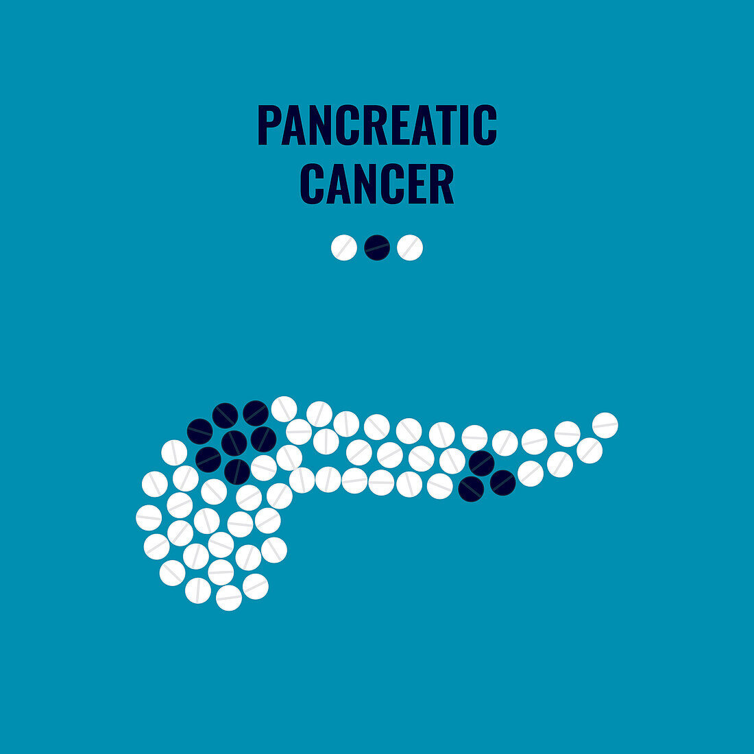 Pancreatic cancer, conceptual illustration