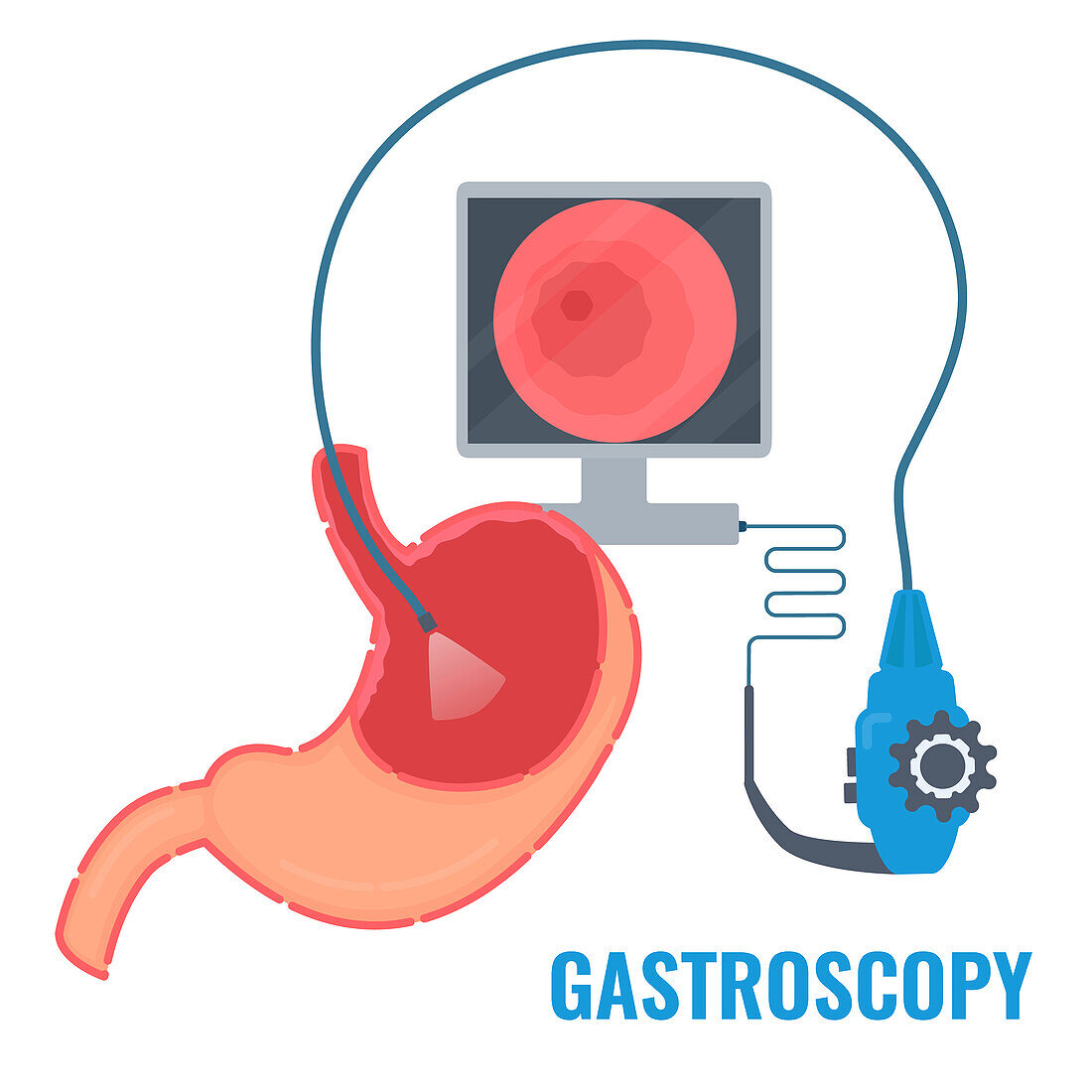 Gastroscopy, conceptual illustration