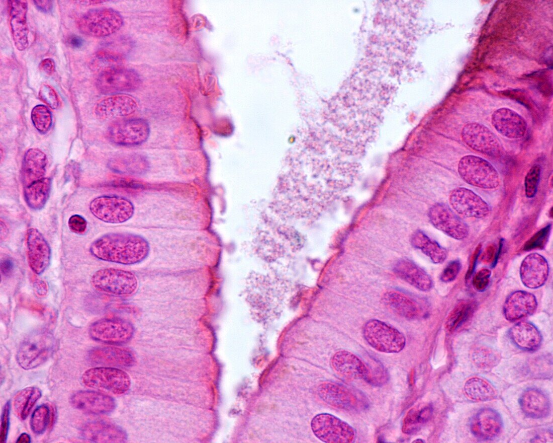 Simple columnar epithelium, light micrograph