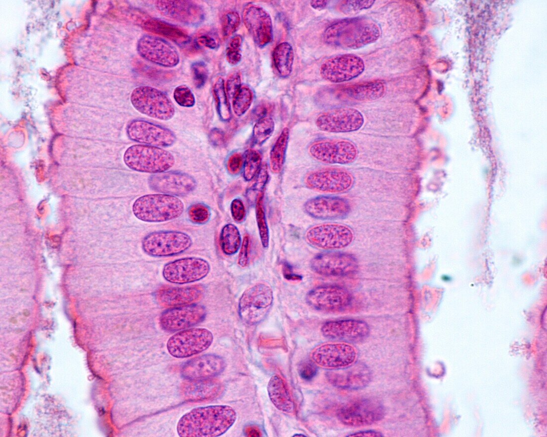 Simple columnar epithelium, light micrograph